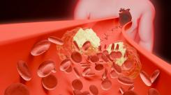 Le contrôle des flux de glucose
